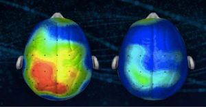 Meditação: o que acontece com seu cérebro é incrível!