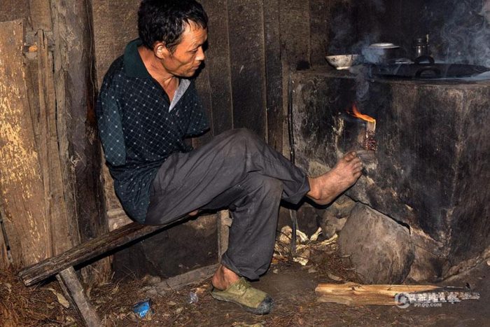 Chen Xinyin, de 48 anos, perdeu os braços depois de sofrer um choque elétrico com sete anos de idade.