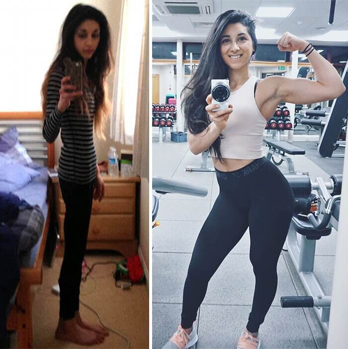 Anorexia Antes e Depois (13)