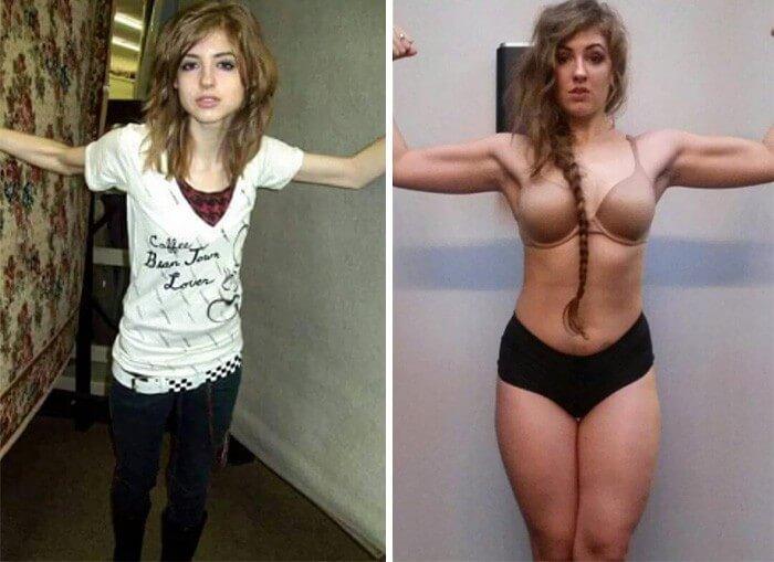 Anorexia Antes e Depois (26)