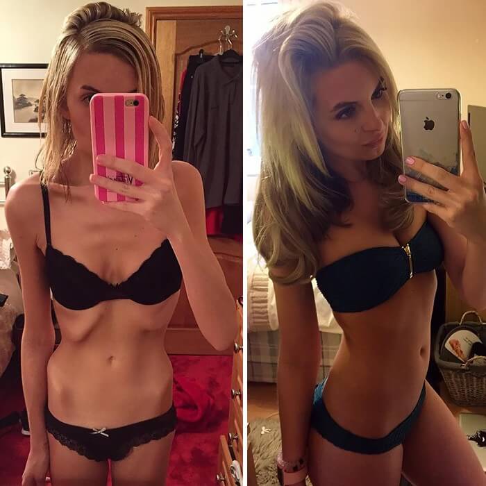 Anorexia Antes e Depois (46)