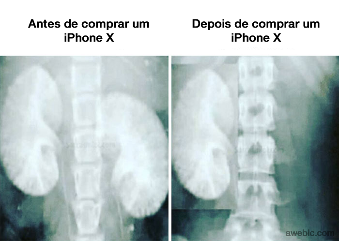 iPhone X (1)