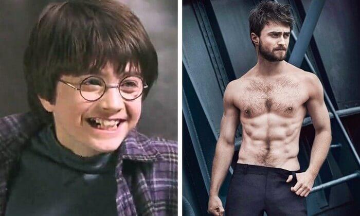 Atores Harry Potter Antes e Depois (1)