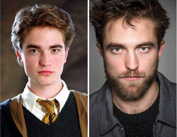 Atores Harry Potter Antes e Depois (14)