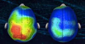 Esta música pode aliviar sua ansiedade em até 65%, segundo neurocientistas