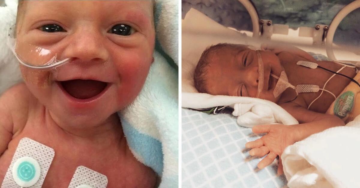 8 bebês prematuros que nasceram sorrindo por estarem vivos