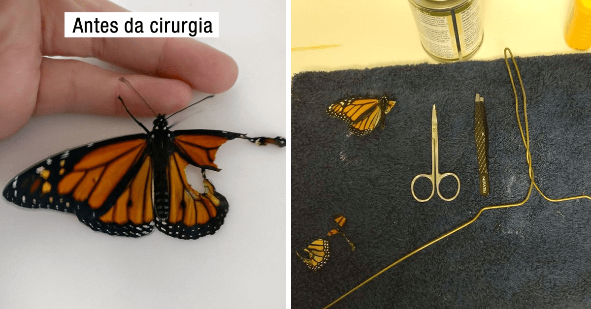 Mulher faz cirurgia na asa de borboleta e tem uma surpresa no dia seguinte