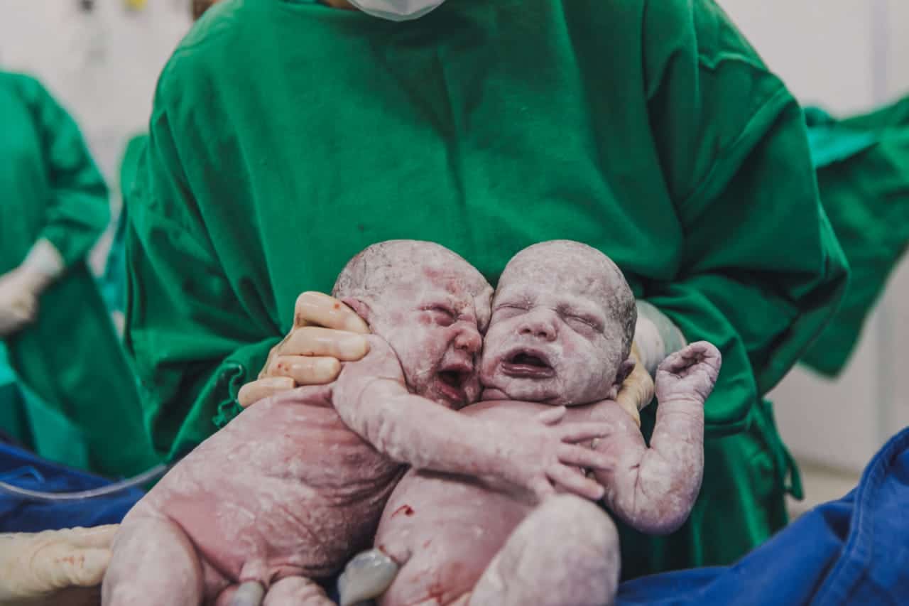 EMOCIONANTE: Gêmeas se abraçam após o nascimento e fotografia se torna viral