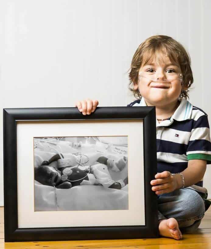 Fotógrafo mostra antes e depois de bebês prematuros e trabalho emociona fortemente