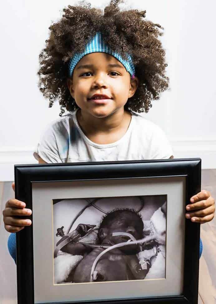 Fotógrafo mostra antes e depois de bebês prematuros e trabalho emociona fortemente