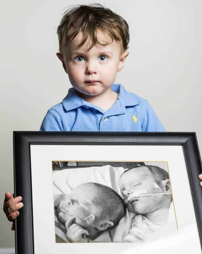 Fotógrafo mostra antes e depois de bebês prematuros e trabalho emociona fortemente