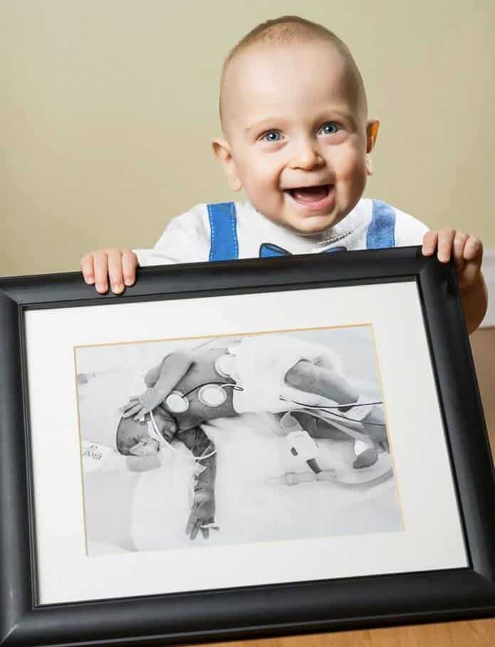 Fotógrafo mostra antes e depois de bebês prematuros e trabalho emociona fortemente