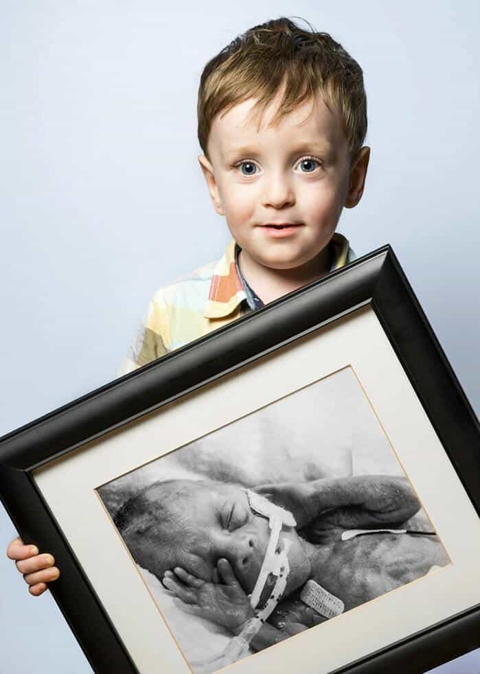 Fotógrafo mostra antes e depois de bebês prematuros e trabalho emociona fortemente