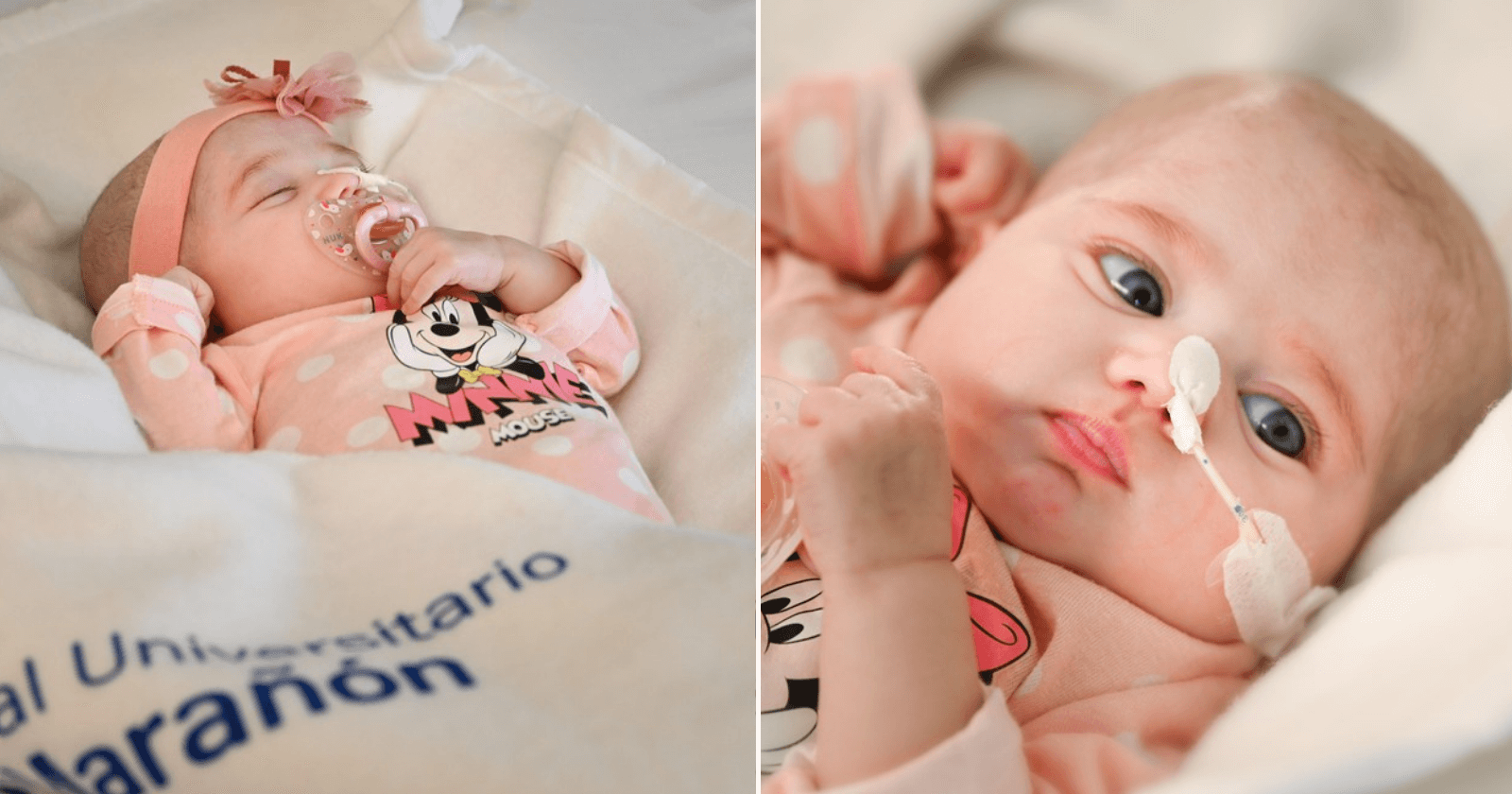 Bebê de 2 meses passa por transplante de coração inédito no mundo!