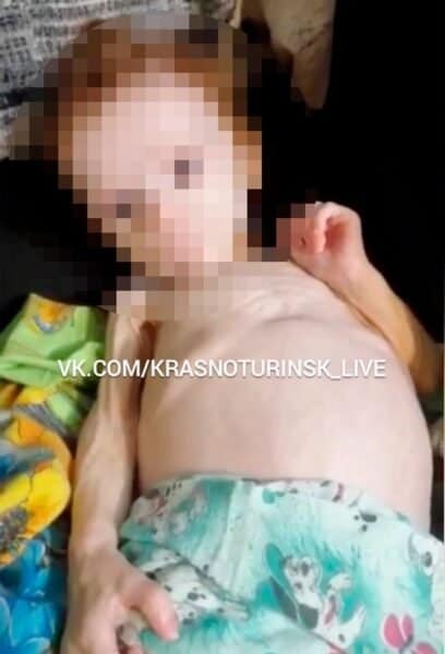 Bebê que estava presa para morrer há 5 meses em armário é resgata