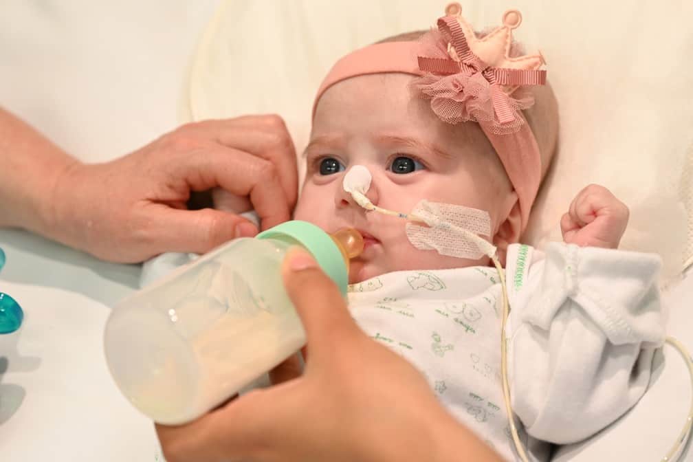 Bebê de 2 meses passa por transplante de coração inédito no mundo!