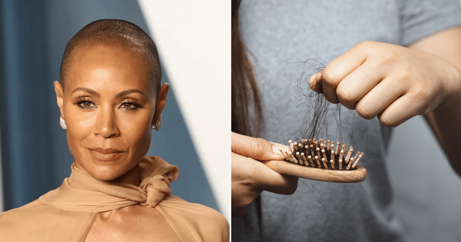 Explicando o que é alopecia, doença que fez a mulher de Will Smith ficar careca