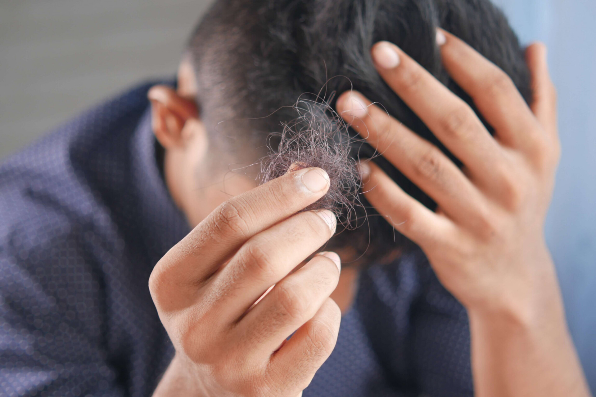 sintomas emocionais alopecia