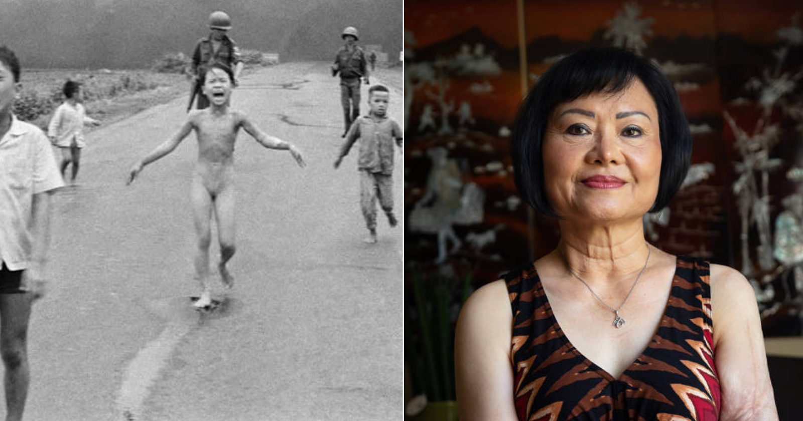 Após 50 anos, mulher que ficou famosa por foto durante Guerra do Vietnã, passa por último procedimento para tratar das cicatrizes