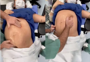 Vídeo impressionante mostra “manobra” feita por médico antes do parto