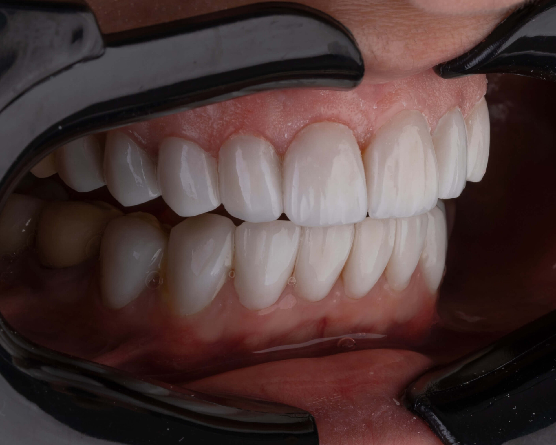 Sonhar com queda de dentes é um alerta para suas emoções (Imagens: Unsplash)