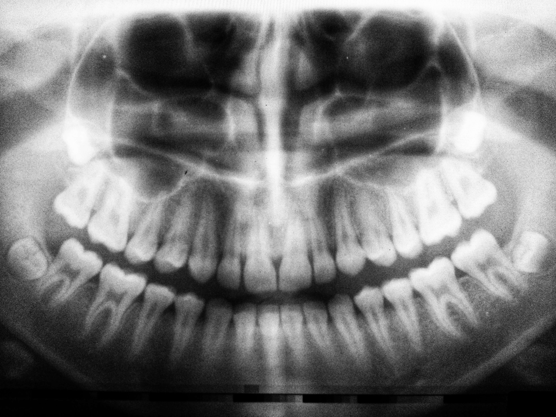 Sonhar com queda de dentes é um alerta para suas emoções (Imagens: Unsplash)